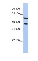 PHACTR3 Antibody - HepG2 cell lysate. Antibody concentration: 1.0 ug/ml. Gel concentration: 12%.  This image was taken for the unconjugated form of this product. Other forms have not been tested.