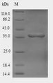 CDH-1 Protein - (Tris-Glycine gel) Discontinuous SDS-PAGE (reduced) with 5% enrichment gel and 15% separation gel.