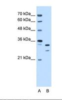 PHAP III / ANP32E Antibody - Lane A: Marker. Lane B: HepG2 cell lysate. Antibody concentration: 0.25 ug/ml. Gel concentration: 12%.  This image was taken for the unconjugated form of this product. Other forms have not been tested.