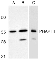 PHAP III / ANP32E Antibody - Western Blot: Use at 1ug/ml. Western blot analysis of PHAP III in A549 (A) and HepG2 (B) cells, and rat testis (C) with PHAP III antibody at 1µg/ml.