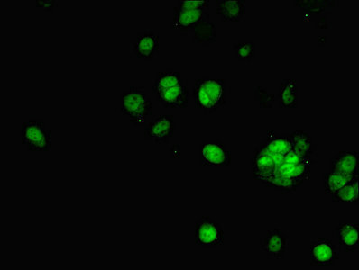 PHAP1 / ANP32A Antibody - Immunofluorescent analysis of MCF-7 cells using ANP32A Antibody at dilution of 1:100 and Alexa Fluor 488-congugated AffiniPure Goat Anti-Rabbit IgG(H+L)