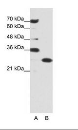 PHAP1 / ANP32A Antibody - A: Marker, B: Jurkat Cell Lysate.  This image was taken for the unconjugated form of this product. Other forms have not been tested.