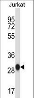 PHAP1 / ANP32A Antibody - ANP32A Antibody western blot of Jurkat cell line lysates (35 ug/lane). The ANP32A antibody detected the ANP32A protein (arrow).