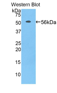 PHAP1 / ANP32A Antibody - Western blot of recombinant PHAP1 / ANP32A.  This image was taken for the unconjugated form of this product. Other forms have not been tested.