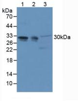 PHAP1 / ANP32A Antibody - Western Blot; Sample: Lane1: Mouse Brain Tissue; Lane2: Mouse Cerebellum Tissue; Lane3: Mouse Lung Tissue.