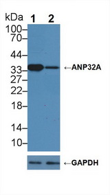 PHAP1 / ANP32A Antibody - Knockout Varification: Lane 1: Wild-type Hela cell lysate; Lane 2: ANP32A knockout Hela cell lysate; Predicted MW: 29kd Observed MW: 35kd Primary Ab: 1µg/ml Rabbit Anti-Human ANP32A Antibody Second Ab: 0.2µg/mL HRP-Linked Caprine Anti-Rabbit IgG Polyclonal Antibody