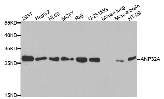 PHAP1 / ANP32A Antibody - Western blot analysis of extracts of various cell lines.
