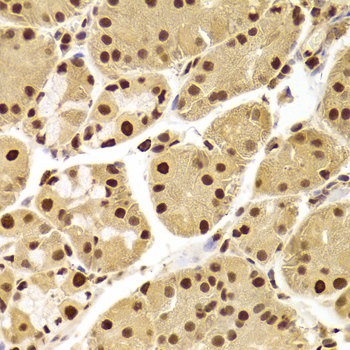 PHAP1 / ANP32A Antibody - Immunohistochemistry of paraffin-embedded Human gastric tissue.