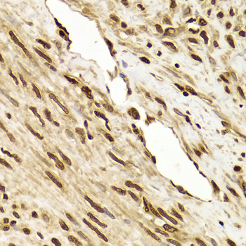 PHAP1 / ANP32A Antibody - Immunohistochemistry of paraffin-embedded Human leiomyoma of uterus.