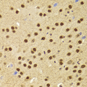 PHAP1 / ANP32A Antibody - Immunohistochemistry of paraffin-embedded Mouse brain tissue.