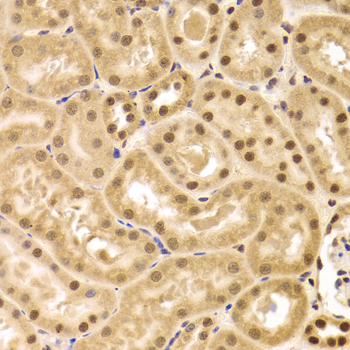PHAP1 / ANP32A Antibody - Immunohistochemistry of paraffin-embedded Mouse kidney tissue.