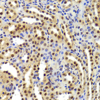 PHAP1 / ANP32A Antibody - Immunohistochemistry of paraffin-embedded Rat kidney tissue.