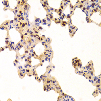 PHAP1 / ANP32A Antibody - Immunohistochemistry of paraffin-embedded Rat lung tissue.
