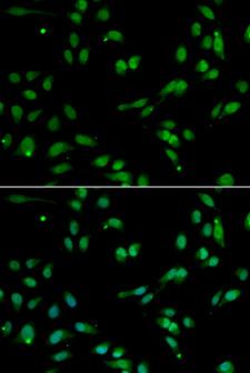 PHAP1 / ANP32A Antibody - Immunofluorescence analysis of A549 cells.