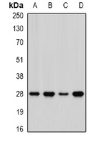 PHAP1 / ANP32A Antibody - Western blot analysis of PHAP1 expression in HepG2 (A); MCF7 (B); mouse lung (C); mouse brain (D) whole cell lysates.