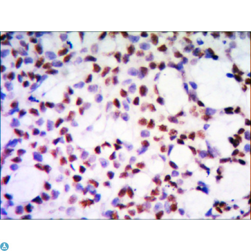 PHAP1 / ANP32A Antibody - Western Blot (WB) analysis using ANP32A Monoclonal Antibody against HeLa (1) cell lysate.