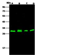 PHAP1 / ANP32A Antibody - Anti-ANP32A rabbit polyclonal antibody at 1:500 dilution. Lane A: HEK293 Whole Cell Lysate. Lane B: Raji Whole Cell Lysate. Lane C: HeLa Whole Cell Lysate. Lane D: Jurkat Whole Cell Lysate. Lysates/proteins at 30 ug per lane. Secondary: Goat Anti-Rabbit IgG H&L (Dylight 800) at 1/10000 dilution. Developed using the Odyssey technique. Performed under reducing conditions. Predicted band size: 28 kDa. Observed band size: 28 kDa.