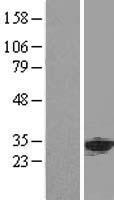 PHAP1 / ANP32A Protein - Western validation with an anti-DDK antibody * L: Control HEK293 lysate R: Over-expression lysate