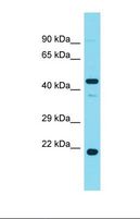 PHAX Antibody - Western blot of Human Fetal Liver. PHAX antibody dilution 1.0 ug/ml.  This image was taken for the unconjugated form of this product. Other forms have not been tested.