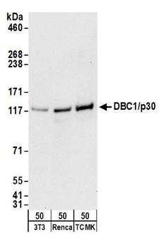PHAX Antibody - Detection of mouse DBC1/p30 by western blot. Samples: Whole cell lysate (50 µg) from NIH 3T3, Renca, and TCMK-1 cells. Antibodies: Affinity purified goat anti-DBC1/p30 antibody used for WB at 0.1 µg/ml. Detection: Chemiluminescence with an exposure time of 30 seconds.