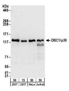 PHAX Antibody - Detection of human DBC1/p30 by western blot. Samples: Whole cell lysate from HEK293T (15 and 50 µg), HeLa (50µg), and Jurkat (50µg) cells. Antibodies: Affinity purified goat anti-DBC1/p30 antibody used for WB at 0.1 µg/ml. Detection: Chemiluminescence with an exposure time of 30 seconds.