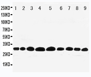 PHB / Prohibitin Antibody - Anti-Prohibitin antibody, Western blotting Lane 1: Rat Lung Tissue LysateLane 2: Rat Skeletal Muscle Tissue LysateLane 3: Rat Brain Tissue LysateLane 4: Rat Kidney Tissue LysateLane 5: HELA Cell LysateLane 6: MCF-7 Cell Lysate Lane 7: PC-12 Cell Lysate Lane 8: A549 Cell Lysate Lane 9: SMMC Cell Lysate