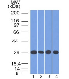 PHB / Prohibitin Antibody - Western blot testing of human 1) A549, 2) K562, 3) A431 and 4) MCF7 cell lysate with PHB antibody (clone PHB/1882). Expected molecular weight ~30 kDa.
