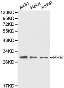 PHB / Prohibitin Antibody - Western blot of PHB pAb in extracts from A431, Hela and Jurkat cells.