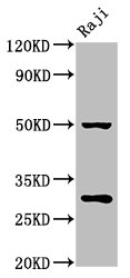 PHB / Prohibitin Antibody - Western Blot Positive WB detected in: Raji whole cell lysate All lanes: PHB antibody at 4.5µg/ml Secondary Goat polyclonal to rabbit IgG at 1/50000 dilution Predicted band size: 30, 18 kDa Observed band size: 30 kDa