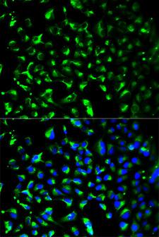 PHB / Prohibitin Antibody - Immunofluorescence analysis of HeLa cells.