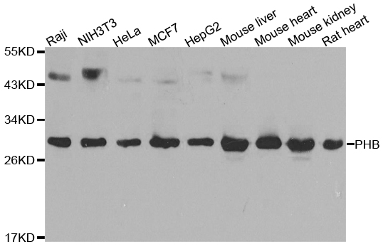 PHB / Prohibitin Antibody - Western blot analysis of extracts of various cell lines, using PHB antibody at 1:1000 dilution. The secondary antibody used was an HRP Goat Anti-Rabbit IgG (H+L) at 1:10000 dilution. Lysates were loaded 25ug per lane and 3% nonfat dry milk in TBST was used for blocking. An ECL Kit was used for detection and the exposure time was 90s.