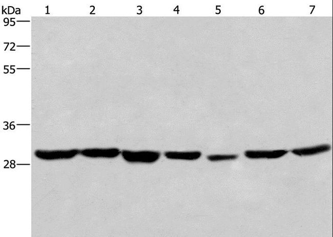 PHB / Prohibitin Antibody - Western blot analysis of 293T and A549 cell,human liver cancer tissue and PC3 cell,human placenta tissue,HeLa cell and mouse heart tissue, using PHB Polyclonal Antibody at dilution of 1:350.