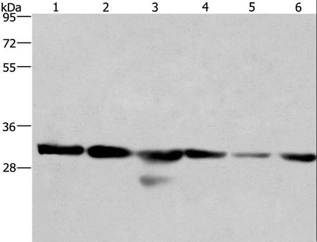 PHB / Prohibitin Antibody - Western blot analysis of 293T and A549 cell, human hepatocellular carcinoma tissue and PC3 cell,HeLa cell and mouse heart tissue, using PHB Polyclonal Antibody at dilution of 1:500.
