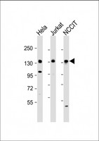 PHC1 / EDR1 Antibody - All lanes: Anti-PHC1 Antibody (N-Term) at 1:2000 dilution. Lane 1: HeLa whole cell lysate. Lane 2: Jurkat whole cell lysate. Lane 3: NCCIT whole cell lysate Lysates/proteins at 20 ug per lane. Secondary Goat Anti-Rabbit IgG, (H+L), Peroxidase conjugated at 1:10000 dilution. Predicted band size: 103 kDa. Blocking/Dilution buffer: 5% NFDM/TBST.