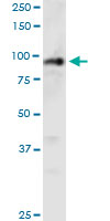 PHC1 / EDR1 Antibody - PHC1 monoclonal antibody (M05), clone 3G1. Western Blot analysis of PHC1 expression in MCF-7.