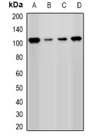 PHC1 / EDR1 Antibody - Western blot analysis of PHC1 expression in HeLa (A); Jurkat (B); A549 (C); mouse kidney (D) whole cell lysates.