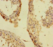 PHC1 / EDR1 Antibody - Immunohistochemistry of paraffin-embedded human testis tissue at dilution of 1:100