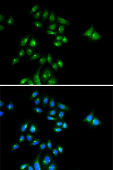 PHC3 Antibody - Immunofluorescence analysis of U2OS cells using PHC3 Polyclonal Antibody.