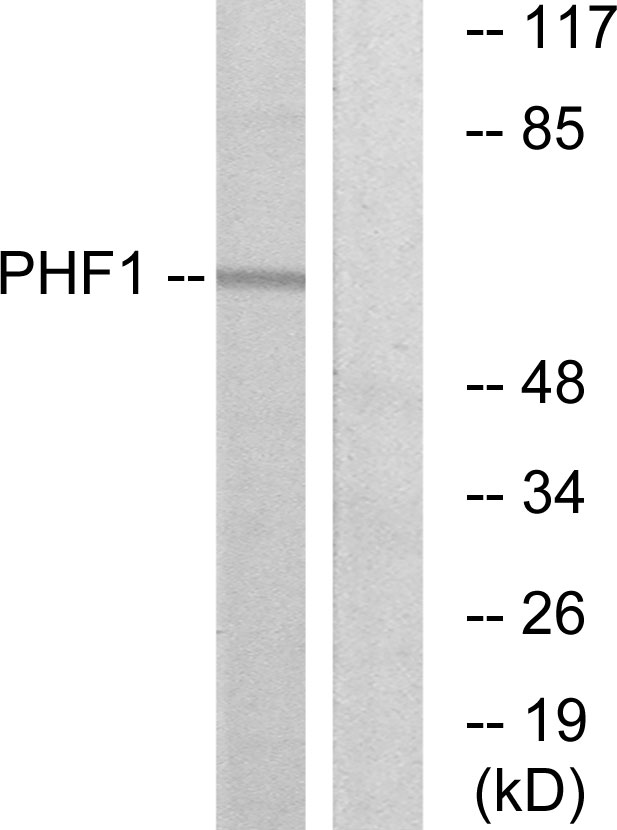 PHF1 Antibody - Western blot analysis of lysates from HeLa cells, using PHF1 Antibody. The lane on the right is blocked with the synthesized peptide.