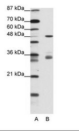 PHF1 Antibody - Western blot of 293T cell Lysate.  This image was taken for the unconjugated form of this product. Other forms have not been tested.