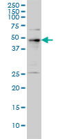 PHF1 Antibody - PHF1 monoclonal antibody (M01), clone 2D3 Western Blot analysis of PHF1 expression in A-431.