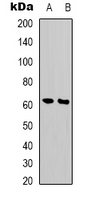 PHF1 Antibody - Western blot analysis of PHF1 expression in MCF7 (A); Jurkat (B) whole cell lysates.