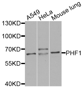 PHF1 Antibody - Western blot analysis of extracts of various cells.