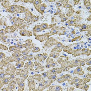 PHF1 Antibody - Immunohistochemistry of paraffin-embedded human liver injury tissue.