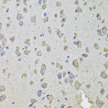 PHF1 Antibody - Immunohistochemistry of paraffin-embedded mouse brain tissue.