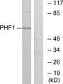 PHF1 Antibody - Western blot analysis of extracts from HeLa cells, using PHF1 antibody.