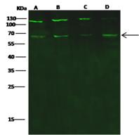PHF1 Antibody - Anti-PHF1 rabbit polyclonal antibody at 1:500 dilution. Lane A: Jurkat Whole Cell Lysate. Lane B: MCF7 Whole Cell Lysate. Lane C: NCI-H1299 Whole Cell Lysate. Lane D: A431 Whole Cell Lysate. Lysates/proteins at 30 ug per lane. Secondary: Goat Anti-Rabbit IgG H&L (Dylight 800) at 1/10000 dilution. Developed using the Odyssey technique. Performed under reducing conditions. Predicted band size: 62 kDa. Observed band size: 67 kDa. (We are unsure as to the identity of these extra bands.)