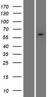 PHF1 Protein - Western validation with an anti-DDK antibody * L: Control HEK293 lysate R: Over-expression lysate