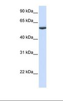 PHF10 Antibody - Fetal lung lysate. Antibody concentration: 1.0 ug/ml. Gel concentration: 12%.  This image was taken for the unconjugated form of this product. Other forms have not been tested.
