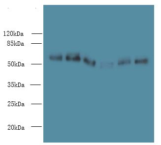 PHF10 Antibody - Western blot. All lanes: PHF10 antibody at 8 ug/ml. Lane 1: HeLa whole cell lysate. Lane 2: 293T whole cell lysate. Lane 3: A2780 whole cell lysate. Lane 4: U251 whole cell lysate. Lane 5: A549 whole cell lysate. Lane 6: A375 whole cell lysate. Secondary Goat polyclonal to Rabbit IgG at 1:10000 dilution. Predicted band size: 56 kDa. Observed band size: 56 kDa.